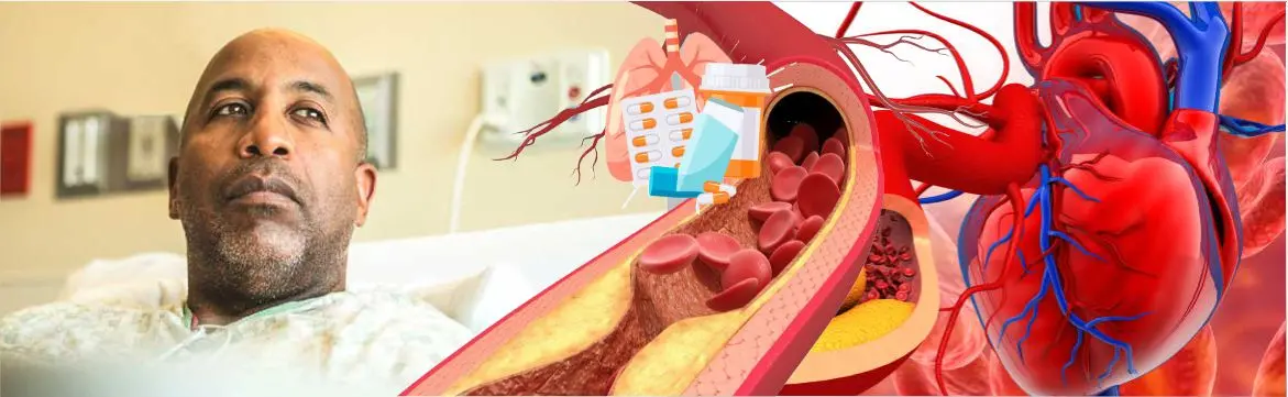 Atherosclerosis Management