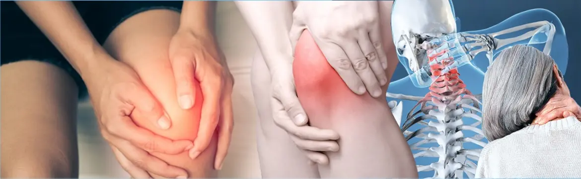 Arthritis Management