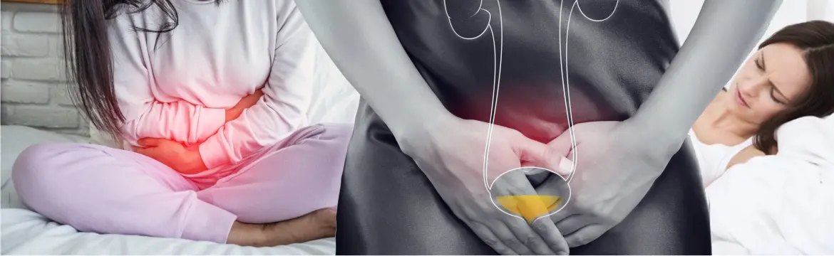 Bladder Infection Management (Female)