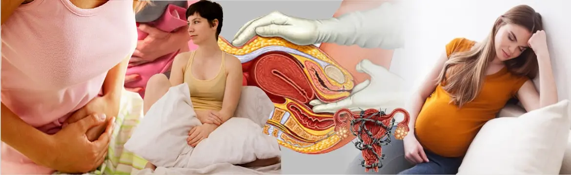 Endometriosis Management