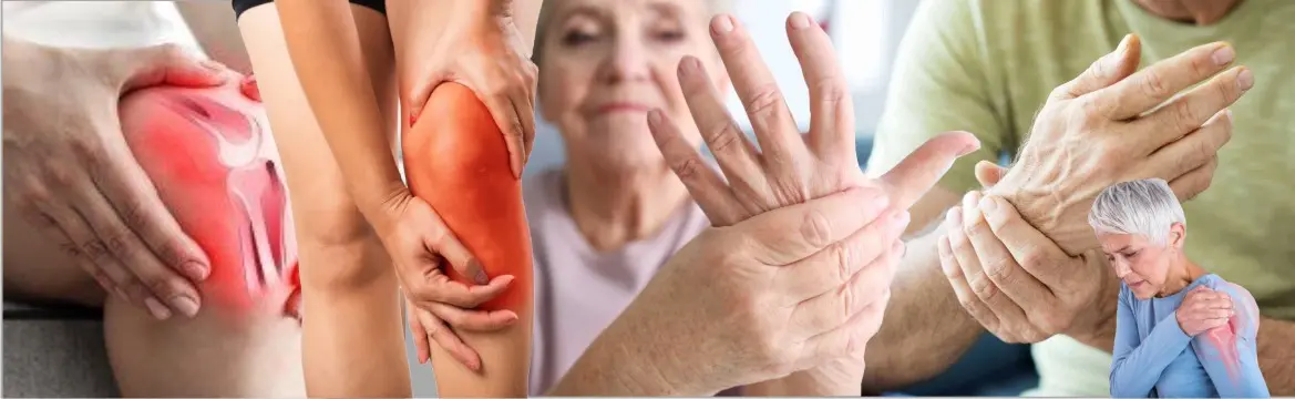 Rheumatism Management